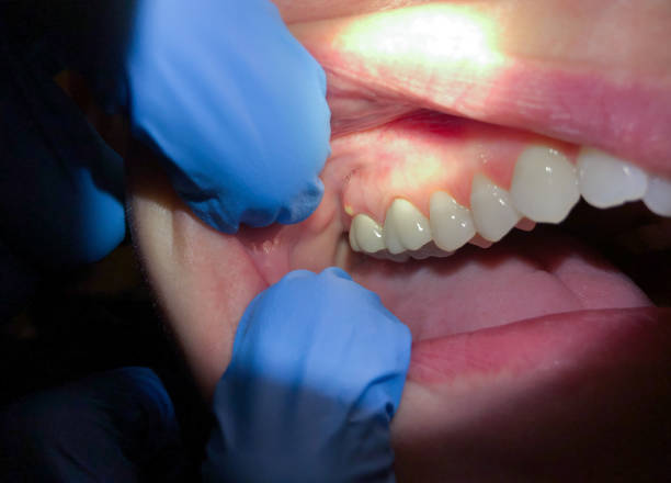 Best Broken or Chipped Tooth Repair in Marlborough, MO
